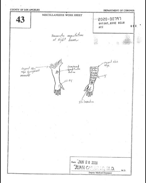 kobe brayant autopsy|Autopsy Reports for Kobe Bryant, Daughter Gigi and 7 Victims of。